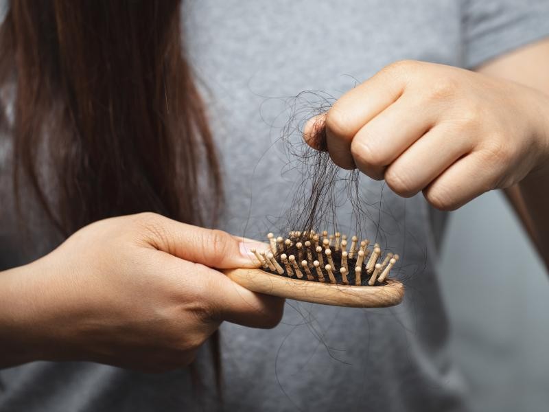 Tratamento para Queda de Cabelo