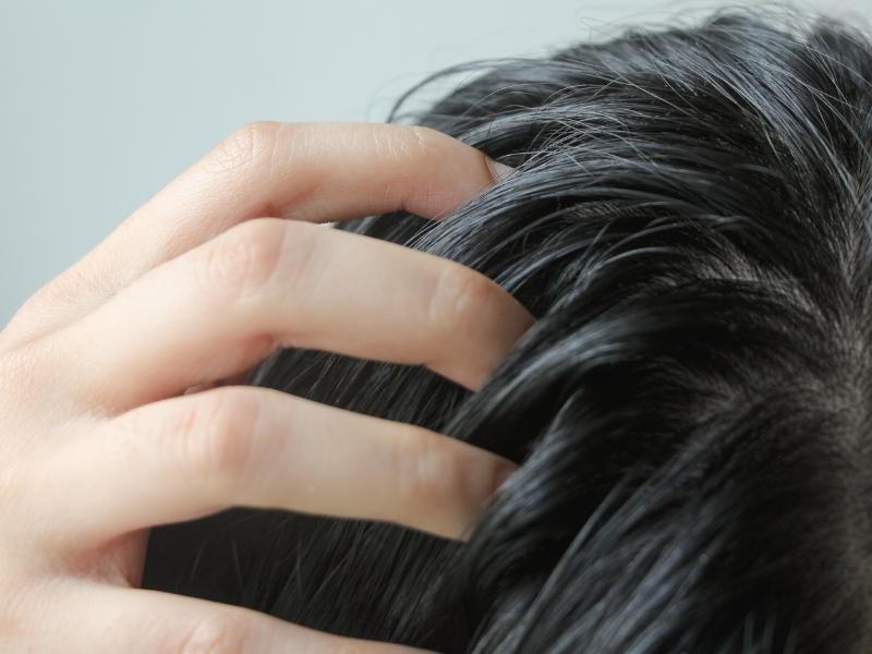 Tratamento para Cabelo Oleoso