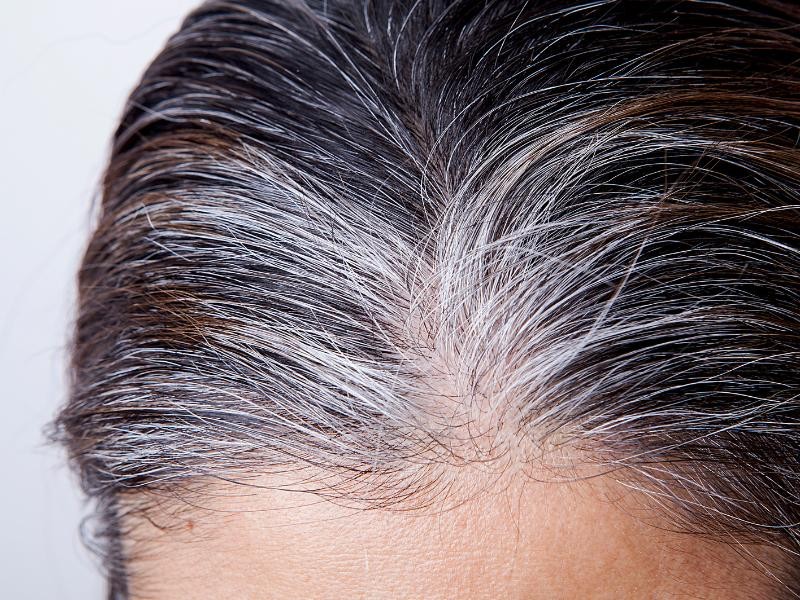 Tratamento para Cabelo Branco